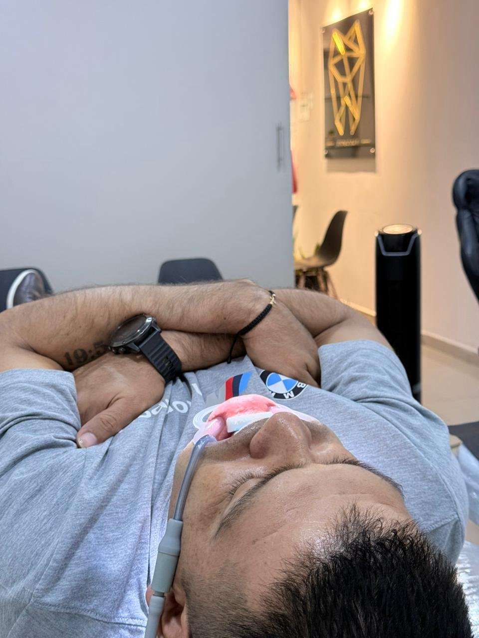 Resultados blanqueamiento dental guiado hombre